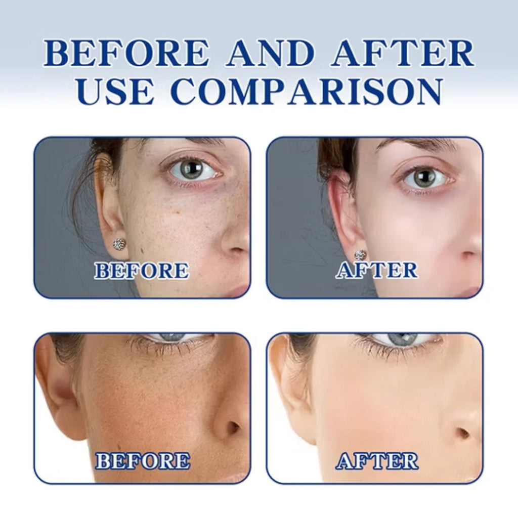 Chalonese Advanced Spot Fading Glow Cream For Radiant Brightening And Even Skin Tone With Daily Care - 20g