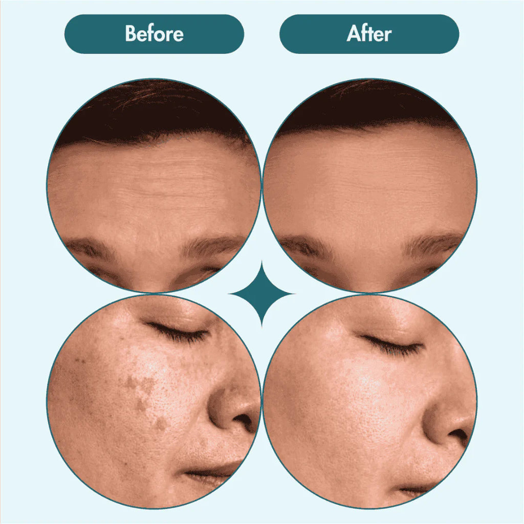 Chalonese Advanced Spot Fading Glow Cream For Radiant Brightening And Even Skin Tone With Daily Care - 20g