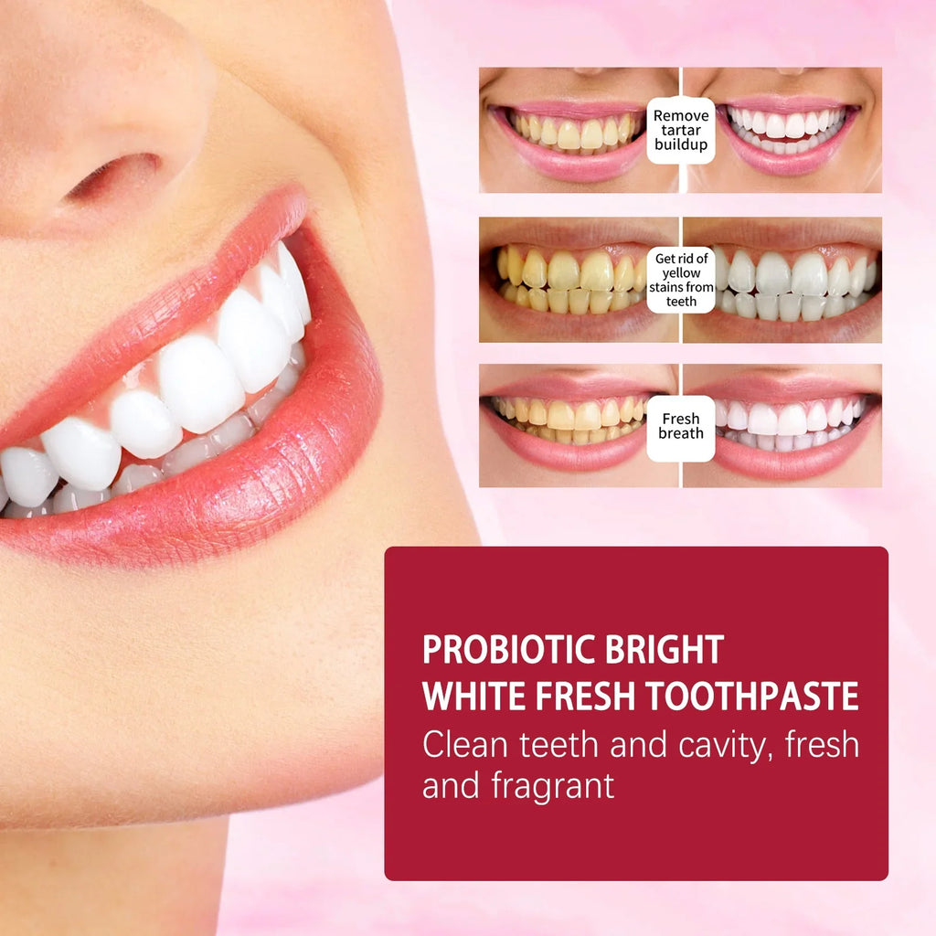Yayashi SP-4 Ultra Whitening Toothpaste 150ml Probiotic Stain Remover for Bright, Healthy Teeth