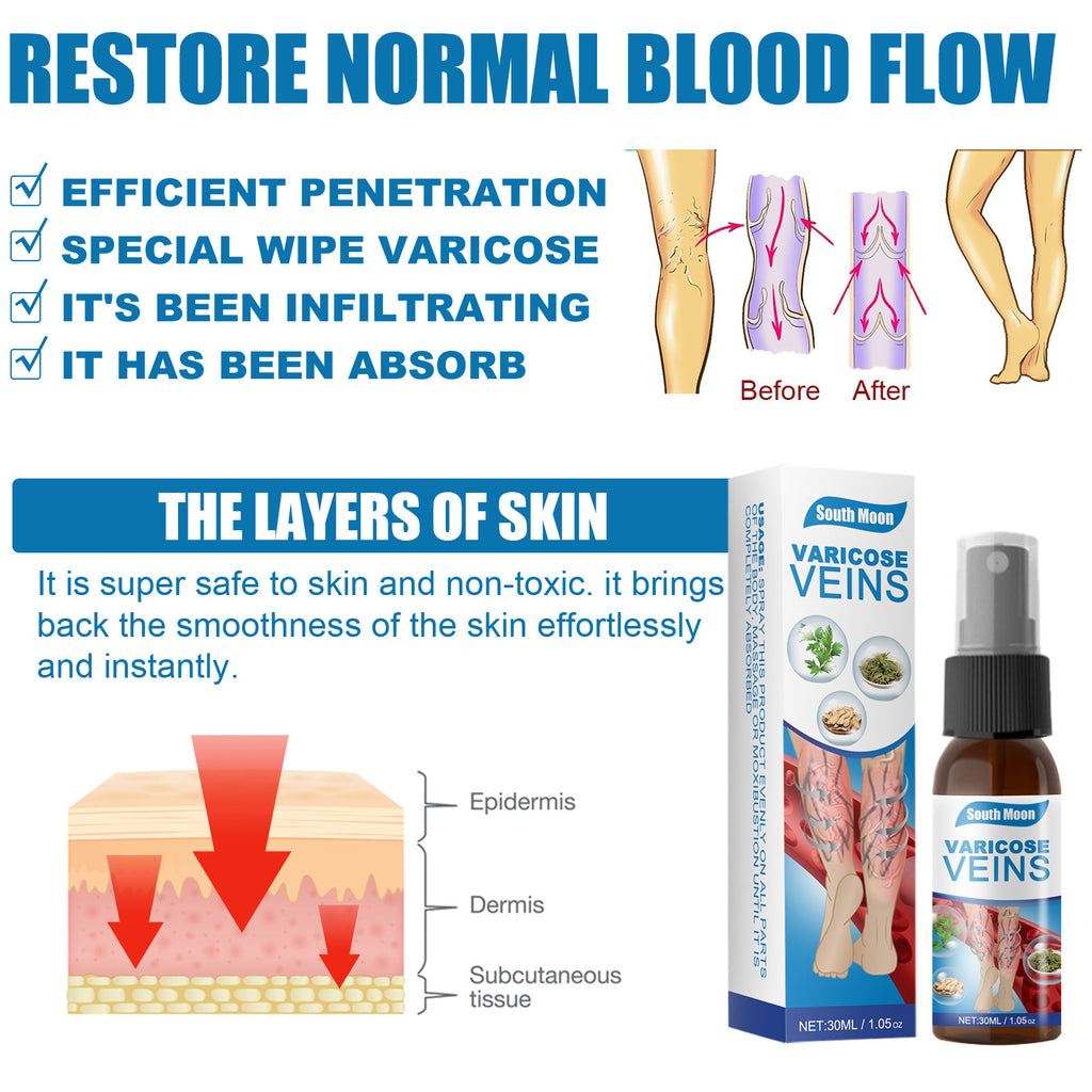 South Moon Varicose Veins Treatment Spray | Advanced Solution for Spider Veins, Leg Pain & Swelling Relief