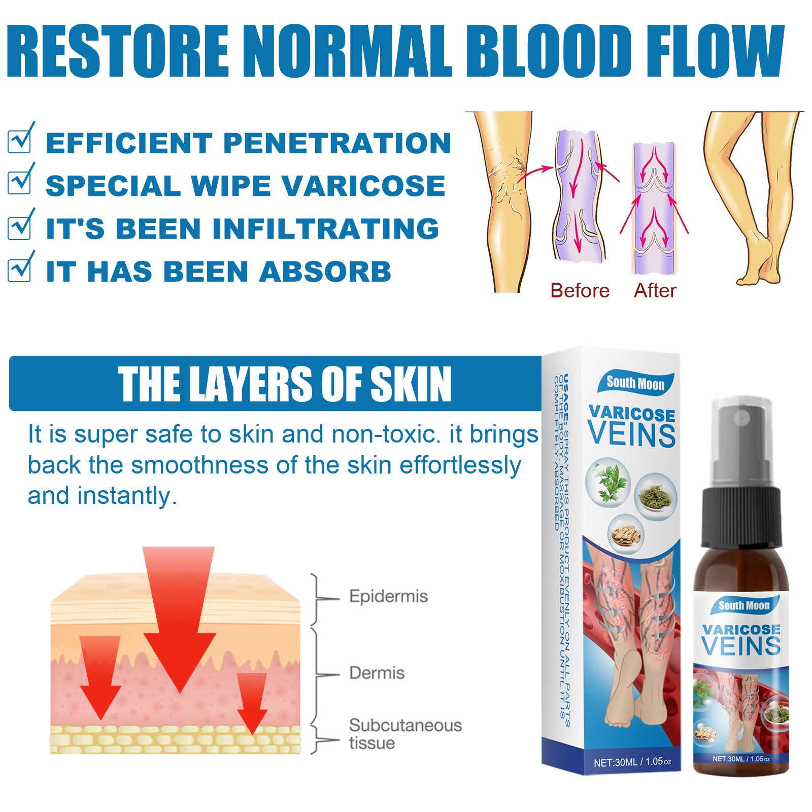South Moon Varicose Veins Treatment Spray | Advanced Solution for Spider Veins, Leg Pain & Swelling Relief