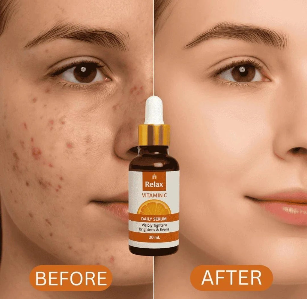 Relax Vitamin C Daily Serum - 30ml Brightening & Anti-Aging Facial Serum