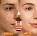 Relax Vitamin C Daily Serum - 30ml Brightening & Anti-Aging Facial Serum