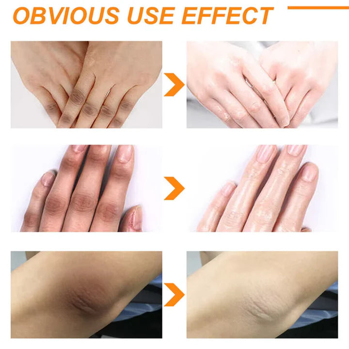 Chalonese Advanced Spot Fading Glow Cream For Radiant Brightening And Even Skin Tone With Daily Care - 20g