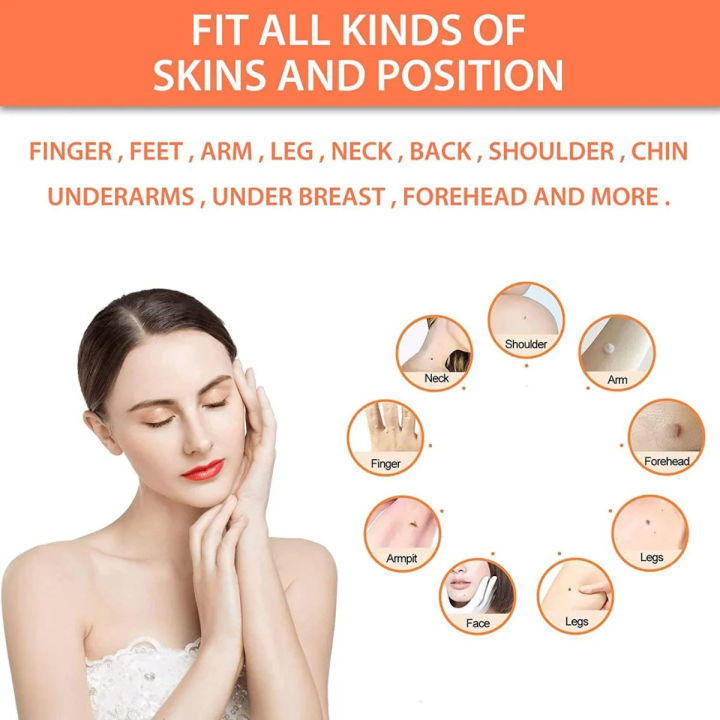 DermaSmooth Skin Tag Remover Patch – Fast, Safe, And Painless Skin Tag And Mole Removal Solution With No Scarring Or Pigmentation